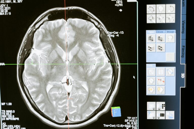Fundamentos da Neurorradiologia Intervencionista