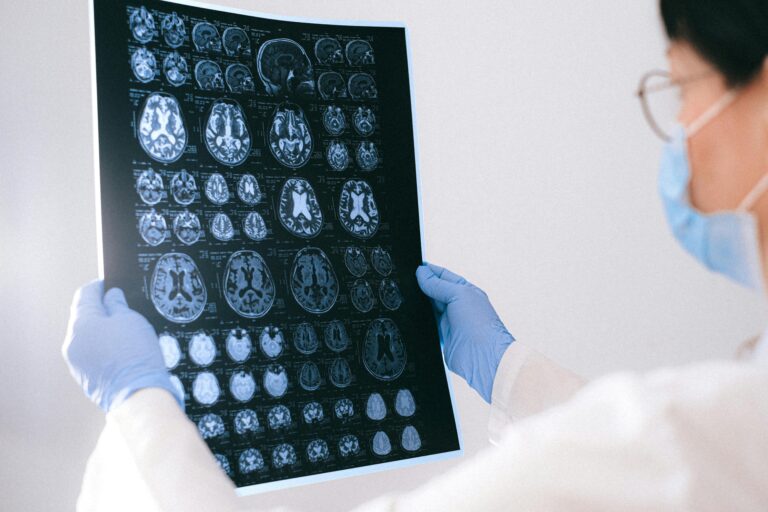 Análise de Imagens em Neurorradiologia Intervencionista